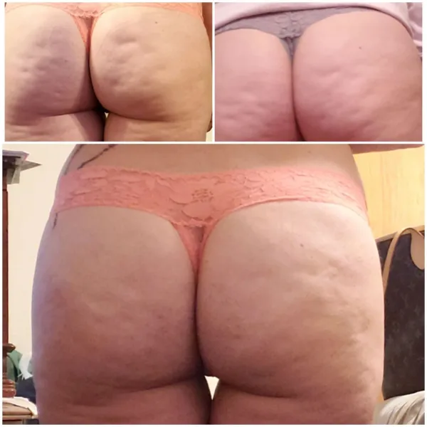 Body Boost Before & After v4